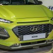 总代理透露部份规格, 本地 Hyundai Kona 将有 Hyundai SmartSense 高科技主动安全辅助配备, 今年第四季上市