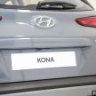 Hyundai Kona 1.6L Turbo dan N Line 2021 dilancarkan di Malaysia — 198 PS, 265 Nm, 7DCT, dari RM146,888