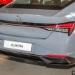 GALERI: Hyundai Elantra 1.6 Executive 2021 – RM140k